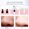 Blackhead Remover machine - Image 4