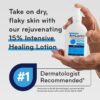 Amlactin Intensive Healing 15% Lactic Acid Moisturizer