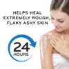 Amlactin Intensive Healing 15% Lactic Acid Moisturizer - Image 2