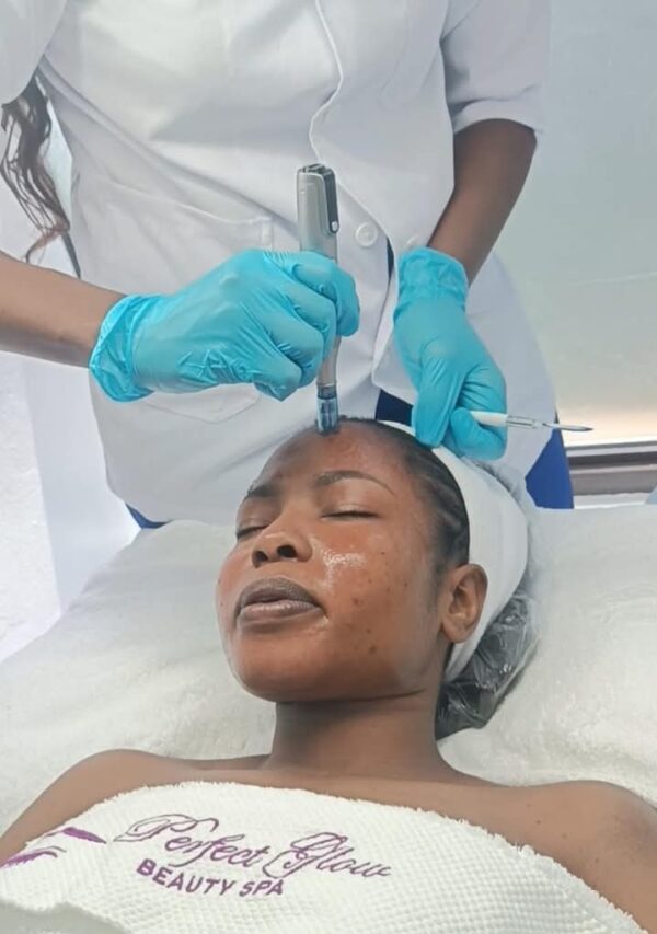 Micro Needling Spa Service