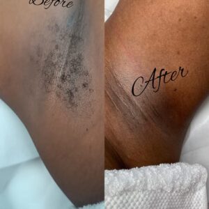 Under Arm Waxing Service