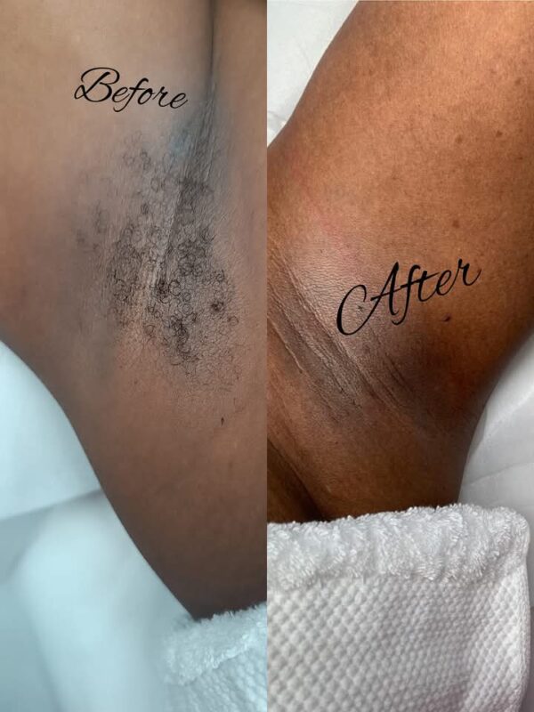 Under Arm Waxing Service